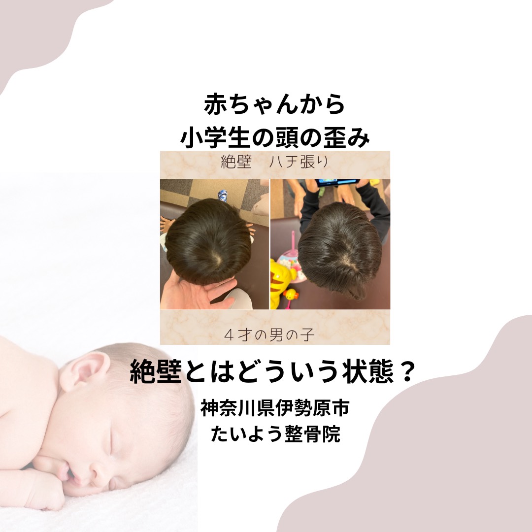 絶壁とは？よくある誤解と本当のところ