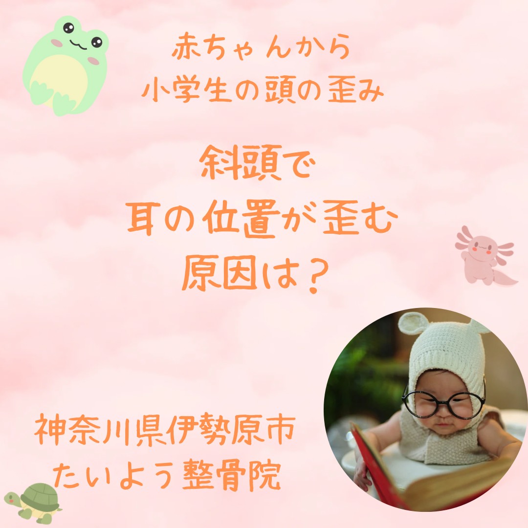 斜頭により耳の位置が歪む。