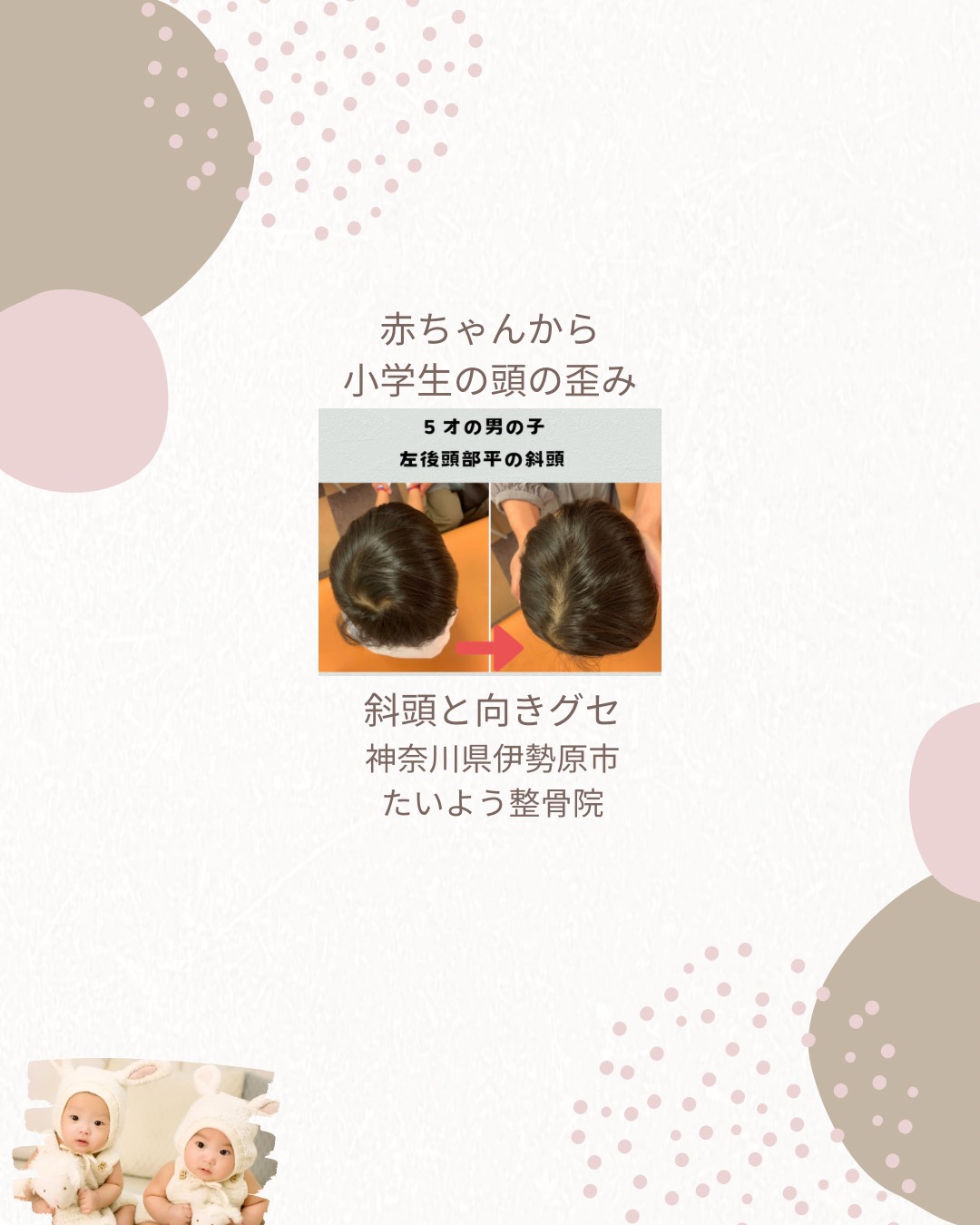 頭の歪みと歯並び・噛み合わせの関係